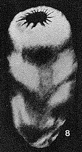 Pseudohyperammina radiostoma Crespin, 1958 Pseudohyperammina radiostoma Crespin, 1958