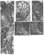 Alpinophragmium perforatum Flügel, 1967