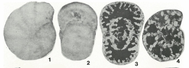 Quasicyclammina breviseptum Belford, 1977
