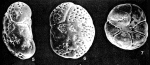 Rotorboides granulosa (Heron-Allen & Earland, 1915)