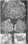 Chromista - Foraminifera (foraminifers)