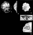 Chromista - Foraminifera (foraminifers)