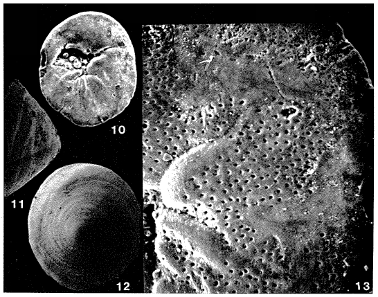 Biasterigerina planorbis (d'Orbigny, 1846) Biasterigerina planorbis (d'Orbigny, 1846)
