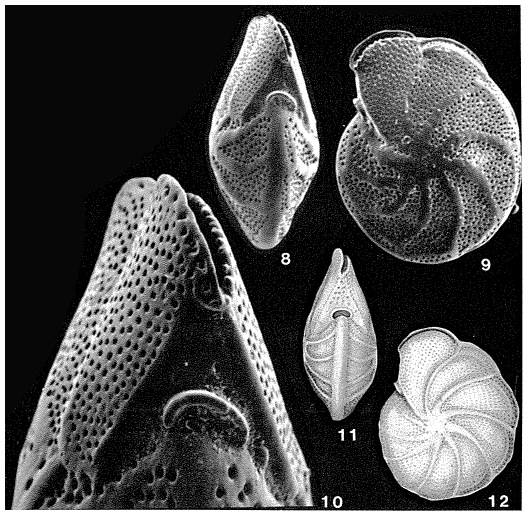 Anomalinella rostrata (Brady, 1881) Anomalinella rostrata (Brady, 1881)