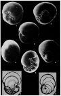 Chilostomina pustulosa Finger & Gapanoff, 1986