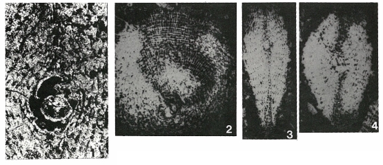 Rhabdorbitoides hedbergi Brönnimann, 1955