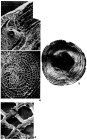 Heterocyclina tuberculata (Möbius, 1880)