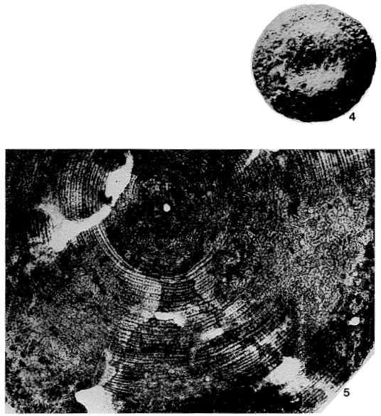 Stenocyclina advena (Cushman, 1921) Stenocyclina advena (Cushman, 1921)