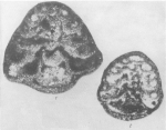 Tetrataxis (Globotetrataxis) grandis Brazhnikova, 1983