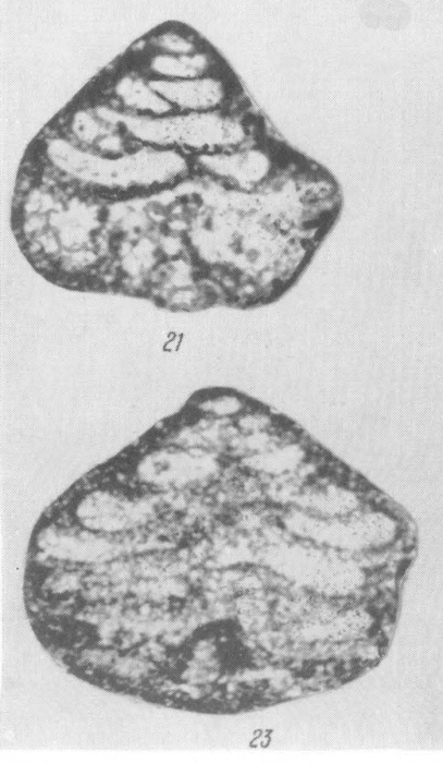 Tetrataxis (Globotetrataxis) elegantula Brazhnikova, 1983