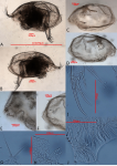 Holotype of Euphilomedes biacutidens Xiang​​, Ye​, Chen, Chen & Lin, 2017