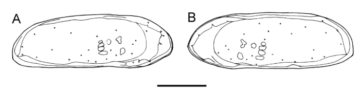 Holotype of Paracobanocythere vietnamensis Tanaka & Le in Tanaka, Le, Higashi & Tsukagoshi, 2016