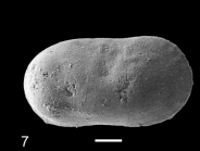 Holotype of Cytherella vulna Slipper, 2019
