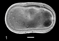 Holotype of Cytherelloidea granulosa parca Slipper, 2019