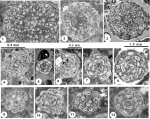 Chromista - Foraminifera (foraminifers)