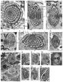 Chromista - Foraminifera (foraminifers)