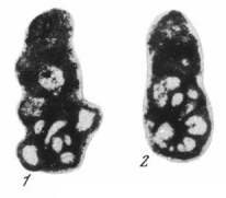 Glomospiroides minutus Reitlinger, 1980 Glomospiroides minutus Reitlinger, 1980