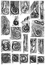 Rectocornuspira kalhori Brönnimann, Zaninetti & Bozorgnia, 1972