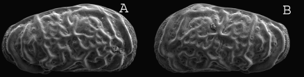 Holotype of Calistocythere intermedia Ha & Tsukagoshi, 2015