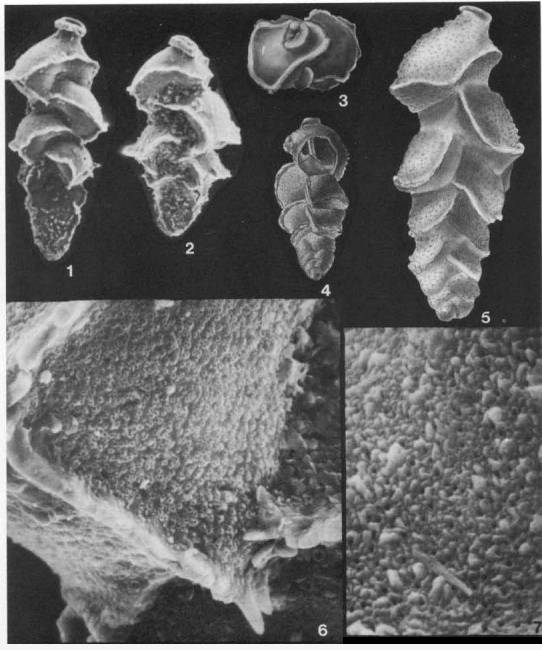 Eouvigerina aculeata (Ehrenberg, 1854)