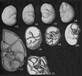 Chromista - Foraminifera (foraminifers)