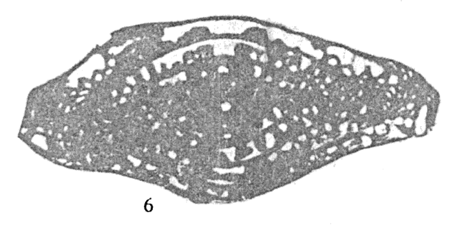 Parabeedeina elegans (Rauzer-Chernousova & Belyaev, 1937) Parabeedeina elegans (Rauzer-Chernousova & Belyaev, 1937)