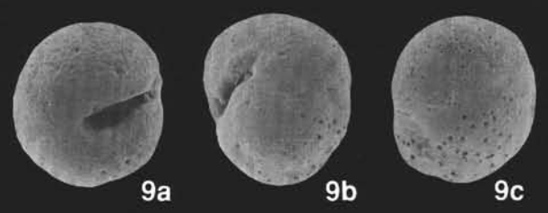 Saitoella globosa Kaiho, 1992 Saitoella globosa Kaiho, 1992