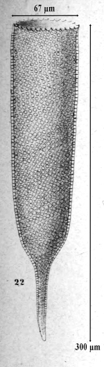 Cyttarocylis denticulata var. robusta