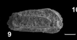 Holotype of Pleurocythere ohmerti Franz, Ebert & Stulpinaite, 2018