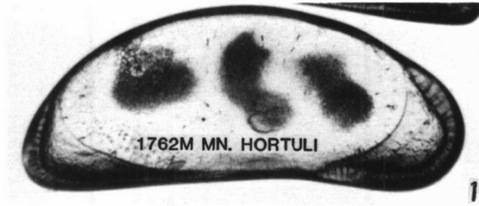 Holotype of Macrocyprina hortuli Maddocks, 1990 Holotype of Macrocyprina hortuli Maddocks, 1990