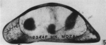 Holotype of Macrocyprina moza Maddocks, 1990