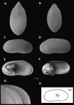 Holotype of Eucypris dorlionensis Batmaz, Yavuzatmaca & Külköylüoglu, 2024