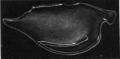 Nealella ornithoides (Brady, 1902)