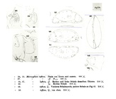 Microcythere inflexa Müller, 1894 - illustrations from the original description