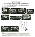 Caribbean Ostracoda