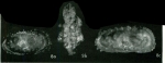 Actinocythereis tesca Bold, 1972 from the original description