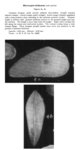 Macrocyprididae