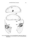 Xestoleberis rubrimaris australiensis Hartmann, 1978 from the original description