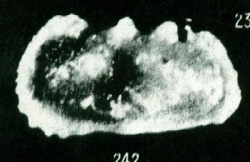 Holotype of Bradleya teiskotensis Apostolescu, 1961 (Ilustration from the original description)