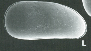 Holotype of Darwinula molopoensis Martens & Rosseti, 1997