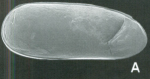 Ostracoda (seed shrimp)