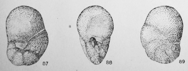 Valvulineria subconica (Terquem, 1882)