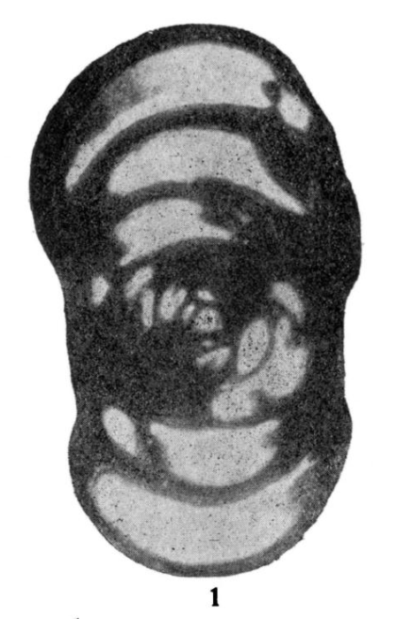Endothyra magna Grozdilova & Lebedeva, 1954 Endothyra magna Grozdilova & Lebedeva, 1954