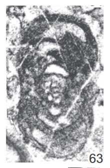 Globoomphalotis aff. magna (Grozdilova & Lebedeva, 1954) Globoomphalotis aff. magna (Grozdilova & Lebedeva, 1954)