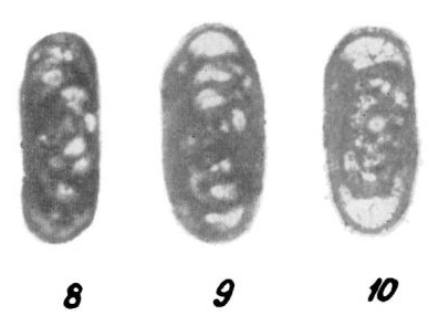 Eostaffella compacta Malakhova, 1975