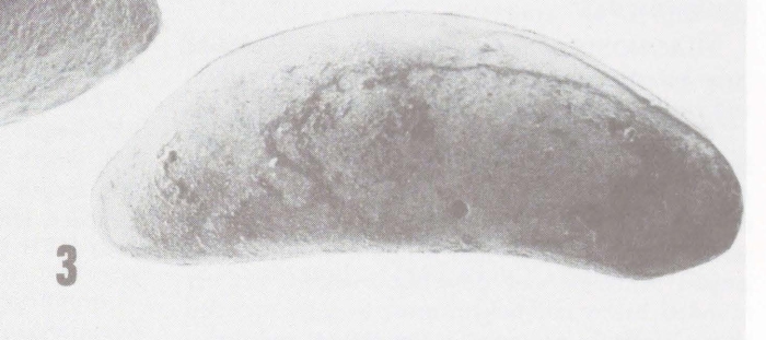 Holotype of Macrocyprina skinneri Kontrovitz, 1976 Holotype of Macrocyprina skinneri Kontrovitz, 1976