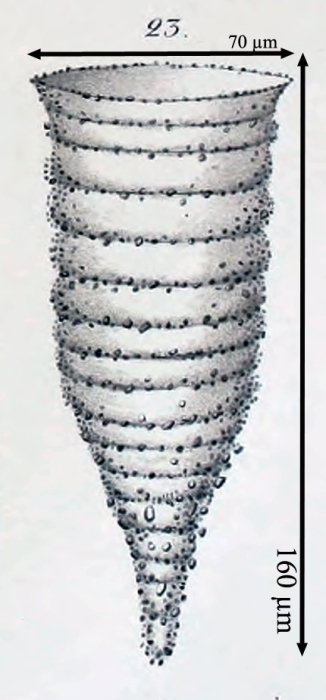 Figure from the original description of Tintinnopsis urniger as Codonella urniger in Entz 1884