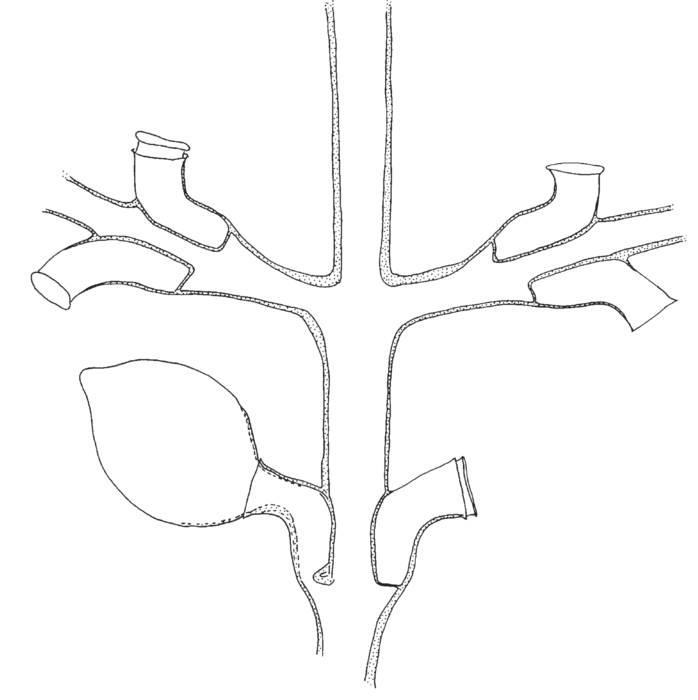 Synthecium flabellum, part of stem and bases of branches, one gonotheca arising from hydrotheca Synthecium flabellum, part of stem and bases of branches, one gonotheca arising from hydrotheca
