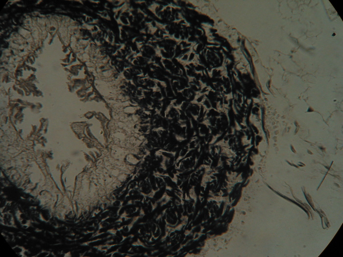 Holotype, transverse section, rhynchocoel wall Holotype, transverse section, rhynchocoel wall