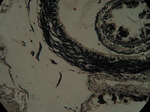 Holotype, transverse section, rhynchocoel wall